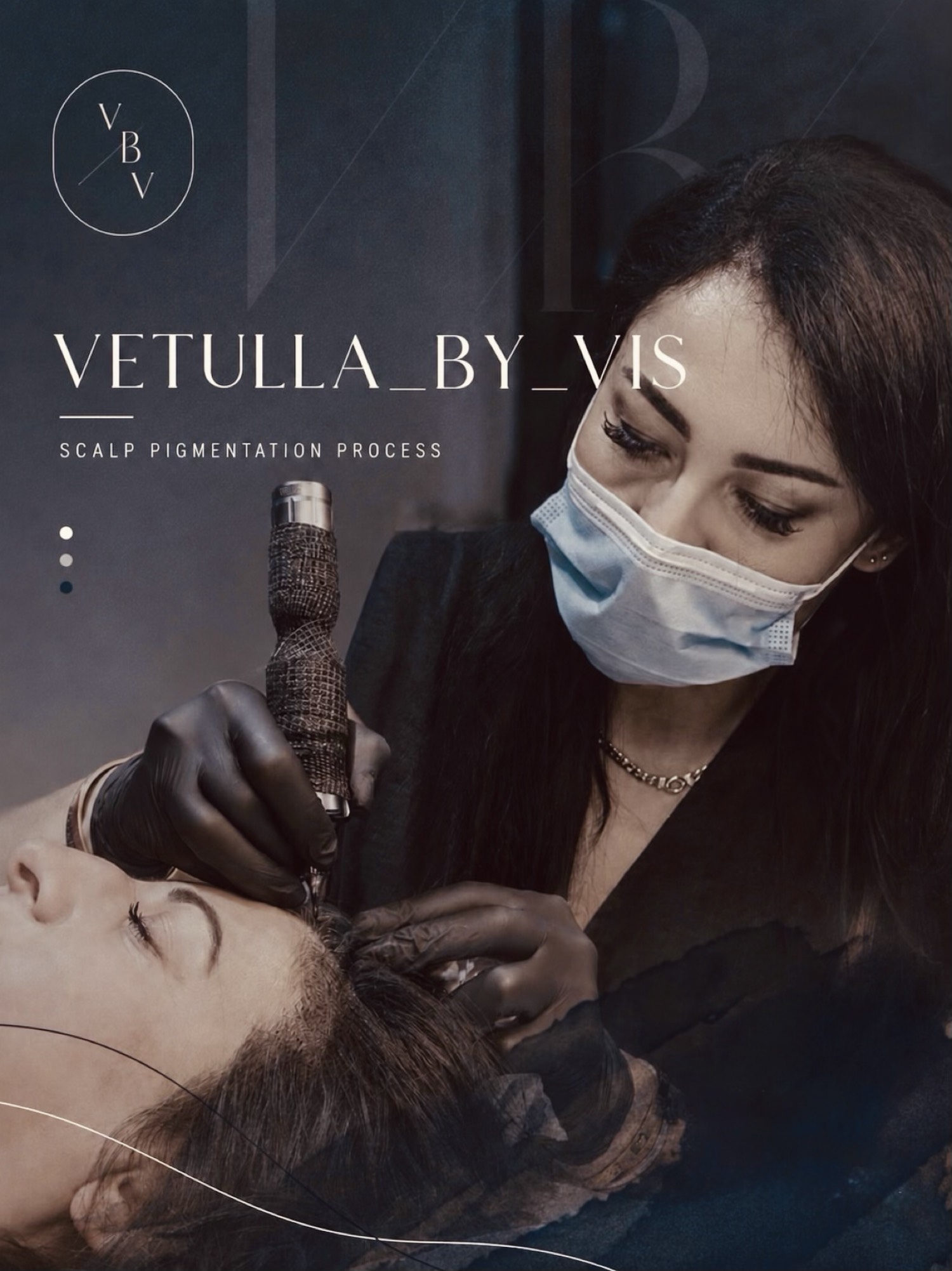 Vetulla by Vis, scalp pigmentation process